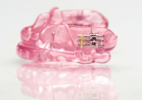 Light pink oral appliance